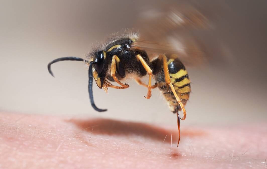 What You Need To Know About European Wasp Stings